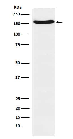 Western Blot: FACA/FANCA Antibody (SR1233) [NBP3-22105] - Western blot analysis using NBP3-22105 in A431 cell lysate.