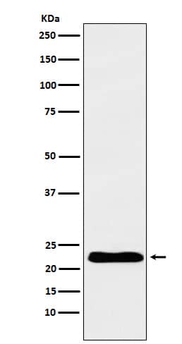 Western Blot: Troponin I Type 1 (slow skeletal) Antibody (SR1356) [NBP3-22106] - Western blot analysis using NBP3-22106 in Human fetal heart lysate.