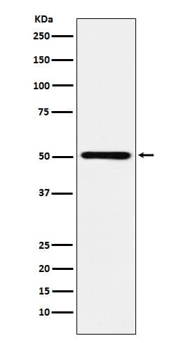 Western Blot: RING1 Antibody (SR1892) [NBP3-22110] - Western blot analysis using NBP3-22110 in Ramos cell lysate.