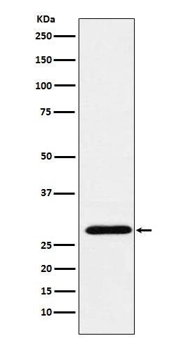 Western Blot: RGS18 Antibody (SR1473) [NBP3-22111] - Western blot analysis using NBP3-22111 in Human PBMC lysate.