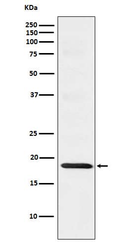 Western Blot: TOMM22 Antibody (SR1301) [NBP3-22112] - Western blot analysis using NBP3-22112 in HeLa cell lysate.