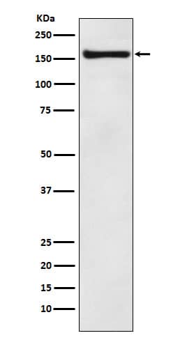 Western Blot: alpha COP I Antibody (SR1142) [NBP3-22116] - Western blot analysis using NBP3-22116 in MCF7 cell lysate.