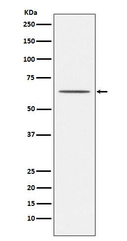 Western Blot: Nogo Receptor/NgR Antibody (SR2112) [NBP3-22117] - Western blot analysis using NBP3-22117 in HepG2 cell lysate.