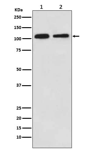 Western Blot: MOV10 Antibody (SR1069) [NBP3-22119] - Western blot analysis using NBP3-22119 in (1) 293 cell lysate; (2) NIH/3T3 cell lysate.