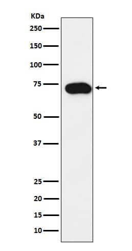 Western Blot: SLC22A1 Antibody (SR2179) [NBP3-22126] - Western blot analysis using NBP3-22126 in SW480 cell lysate.