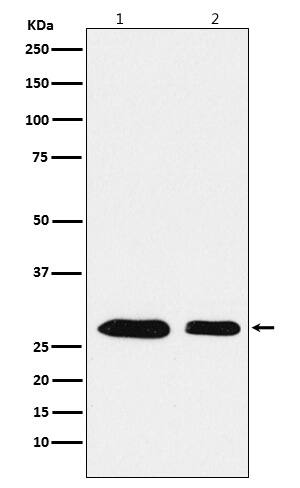 Western Blot: ANP32B Antibody (SR1488) [NBP3-22127] - Western blot analysis using NBP3-22127 in (1) Jurkat cell lysate; (2) RAW264.7 cell lysate.