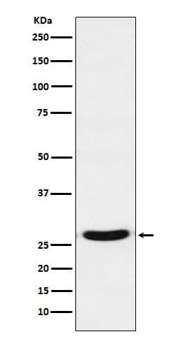 Western Blot TCF21 Antibody (SR1424)