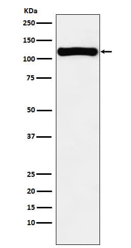 Western Blot: VPS11 Antibody (SR1048) [NBP3-22131] - Western blot analysis using NBP3-22131 in K562 cell lysate.