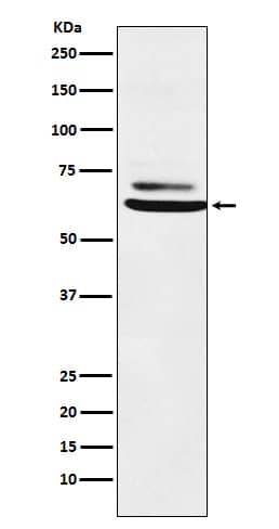 Western Blot: ENT2 Antibody (SR1973) [NBP3-22134] - Western blot analysis using NBP3-22134 in K562 cell lysate.