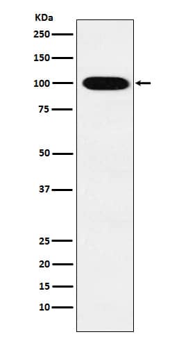 Western Blot: VPS18 Antibody (SR1024) [NBP3-22137] - Western blot analysis using NBP3-22137 in K562 cell lysate.