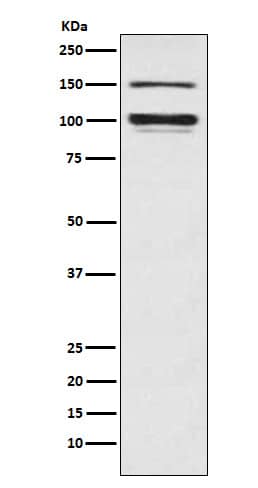 Western Blot: Sodium Potassium ATPase Alpha 3 Antibody (SR1002) [NBP3-22145] - Western blot analysis using NBP3-22145 in Rat brain lysate.