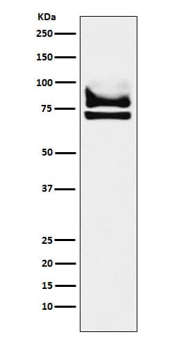 Western Blot: DDX17 Antibody (SR2137) [NBP3-22156] - Western blot analysis using NBP3-22156 in 293T cell lysate.