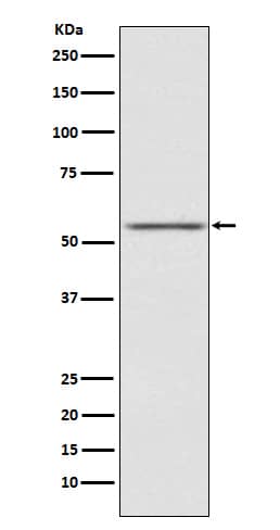 Western Blot: MIS RII/AMHR2 Antibody (SR1978) [NBP3-22158] - Western blot analysis using NBP3-22158 in SK-OV-3 cell lysate.