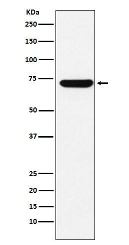 Western Blot: ZBTB7A/Pokemon Antibody (SR2167) [NBP3-22161] - Western blot analysis using NBP3-22161 in HepG2 cell lysate.
