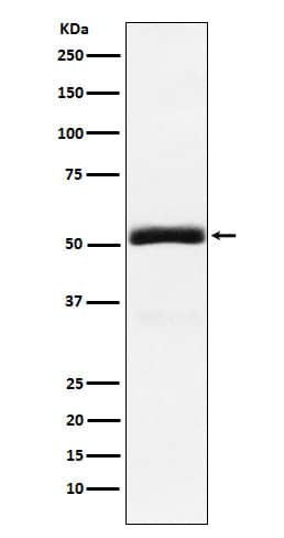 Western Blot: Granulin Antibody (SR1971) [NBP3-22170] - Western blot analysis using NBP3-22170 in 293T cell lysate.