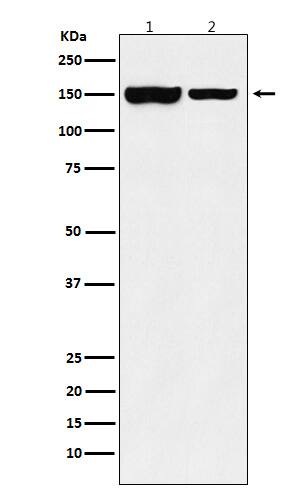 Western Blot: JMJD2B Antibody (SR1194) [NBP3-22174] - Western blot analysis using NBP3-22174 in (1) SW480 cell lysate; (2) Mouse testis cell lysate.