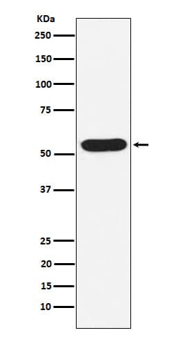 Western Blot: WASP Antibody (SR2069) [NBP3-22175] - Western blot analysis using NBP3-22175 in Jurkat cell lysate.