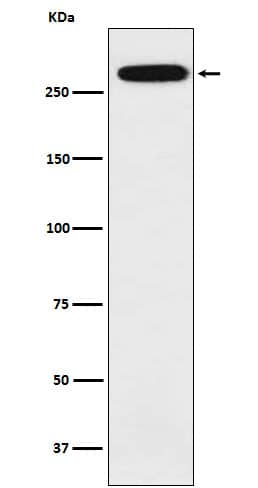 Western Blot: Spectrin alpha 1 Antibody (SR1447) [NBP3-22179] - Western blot analysis using NBP3-22179 in K562 cell lysate.