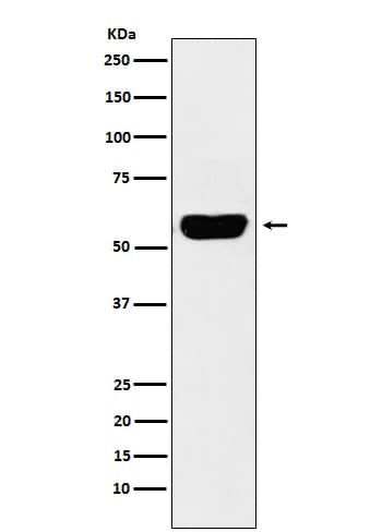 Western Blot: Salivary Amylase Alpha Antibody (SR2033) [NBP3-22180] - Western blot analysis using NBP3-22180 in Human pancreas lysate.