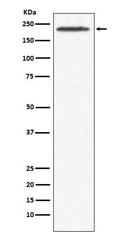 Western Blot: SMCHD1 Antibody (SR1339) [NBP3-22190] - Western blot analysis using NBP3-22190 in 293T cell lysate.