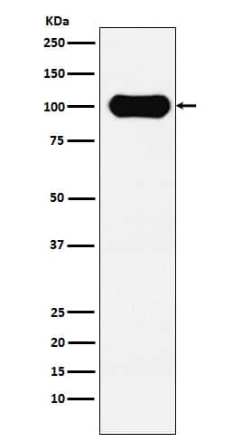 Western Blot: FE65 Antibody (SR1014) [NBP3-22195] - Western blot analysis using NBP3-22195 in SH-SY5Y cell lysate.