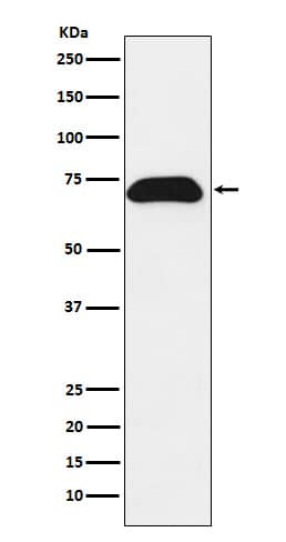 Western Blot: PDZK1 Antibody (SR2158) [NBP3-22197] - Western blot analysis using NBP3-22197 in T47-D cell lysate.