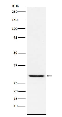 Western Blot: TIRAP Antibody (SR1476) [NBP3-22201] - Western blot analysis using NBP3-22201 in HUVEC cell lysate.