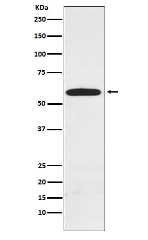 Western Blot: HR23A/Rad23A TUBE1 Antibody (SR1997) [NBP3-22203] - Western blot analysis using NBP3-22203 in MCF7 cell lysate.