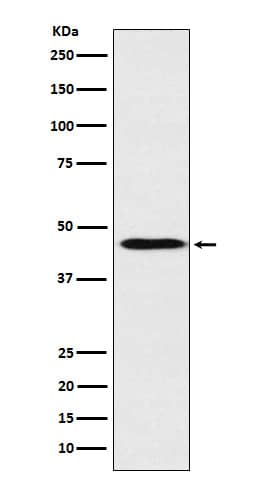 Western Blot: Apolipoprotein A-IV/ApoA4 Antibody (SR1758) [NBP3-22204] - Western blot analysis using NBP3-22204 in Human plasma lysate.