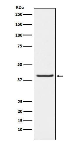 Western Blot: PAWR Antibody (SR1674) [NBP3-22208] - Western blot analysis using NBP3-22208 in LnCaP cell lysate.