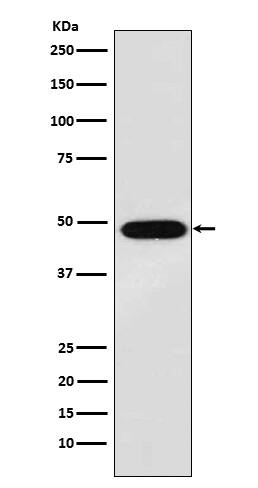 Western Blot: MAGE 1 Antibody (SR1797) [NBP3-22211] - Western blot analysis using NBP3-22211 in A375 cell lysate.