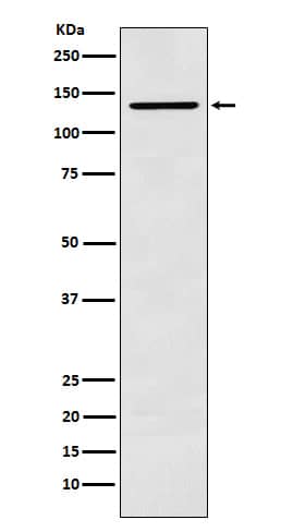 Western Blot: CARD11/CARMA1 Antibody (SR1136) [NBP3-22214] - Western blot analysis using NBP3-22214 in K562 cell lysate.