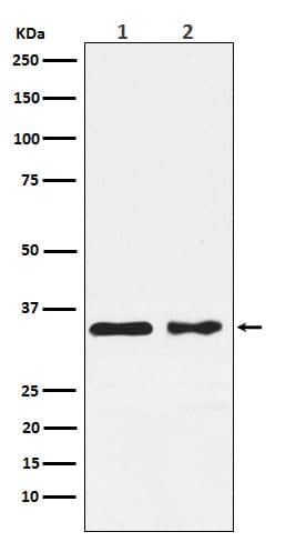 Western Blot: Casein Kinase 1 alpha Antibody (SR1581) [NBP3-22219] - Western blot analysis using NBP3-22219 in (1) MCF7 cell lysate; (2) NIH/3T3 cell lysate.