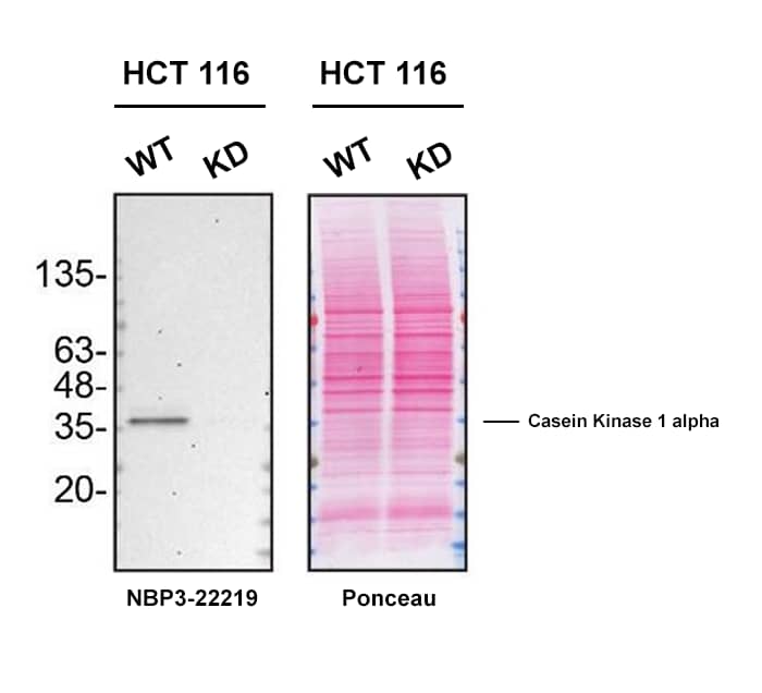 <b>Genetic Strategies Validation. </b>Western blot shows lysates of HCT 116 human colorectal carcinoma cell line and Casein Kinase 1 alpha knockdown HCT 116 cell line (KD). Nitrocellulose membrane was probed with Casein Kinase 1 alpha Antibody (SR1581) (Catalog # NBP3-22219) followed by an HRP-conjugated secondary antibody. A specific band was detected for Casein Kinase 1 alpha at approximately 36 kDa (as indicated) in the parental HCT 116 cell line, but is significantly reduced in knockdown HCT 116 cell line. Primary antibody dilution used: 1/500. The Ponceau stained transfer of the blot is shown. This experiment was conducted under reducing conditions. Image, protocol, and testing courtesy of YCharOS Inc. See ycharos.com for additional details.