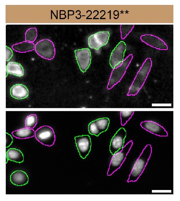 <b>Genetic Strategies Validation. </b>HCT 116 WT and Casein Kinase 1 alpha KD cells were labelled with a green or a far-red fluorescent dye, respectively. Cells were stained with Casein Kinase 1 alpha Antibody (SR1581) (Catalog # NBP3-22219) and with an Alexa-fluor 555 coupled secondary antibody including DAPI. Acquisition of the blue (nucleus-DAPI), green (identification of WT cells), red (antibody staining) and far-red (identification of KD cells) channels was performed. Representative images of the blue and red (grayscale) channels are shown. WT and KD cells are outlined with green and magenta dashed line, respectively. Primary antibody dilution used: 1/500. Image, protocol and testing courtesy of YCharOS Inc. (ycharos.com).