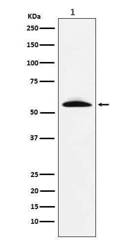 Western Blot: GGT1 Antibody (SR1854) [NBP3-22221] - Western blot analysis using NBP3-22221 in Human fetal liver lysate.