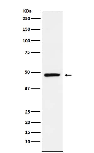 Western Blot: TLX/NR2E1 Antibody (SR1840) [NBP3-22225] - Western blot analysis using NBP3-22225 in SH-SY5Y cell lysate.