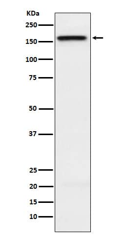 Western Blot: Kif4A Antibody (SR1195) [NBP3-22228] - Western blot analysis using NBP3-22228 in HeLa cell lysate.