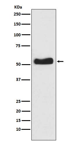 Western Blot: Glucokinase/GCK Antibody (SR1917) [NBP3-22233] - Western blot analysis using NBP3-22233 in BxPC-3 cell lysate.