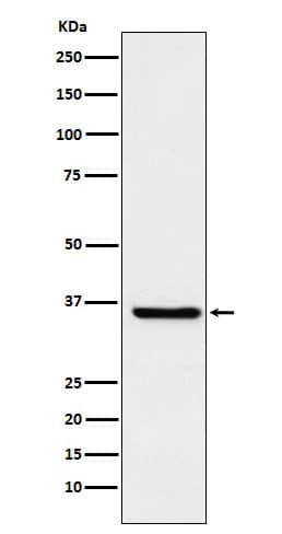 Western Blot: FGF-19 Antibody (SR1597) [NBP3-22237] - Western blot analysis using NBP3-22237 in Human fetal liver lysate.