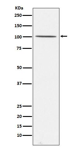 Western Blot: Gemin 3 Antibody (SR1015) [NBP3-22239] - Western blot analysis using NBP3-22239 in 293T cell lysate.