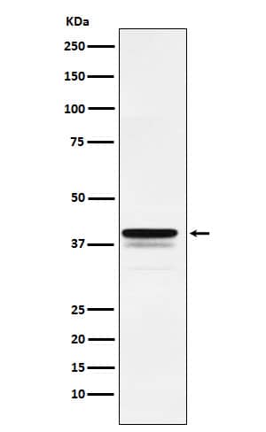 Western Blot: FoxF1 Antibody (SR1668) [NBP3-22241] - Western blot analysis using NBP3-22241 in HeLa cell lysate.