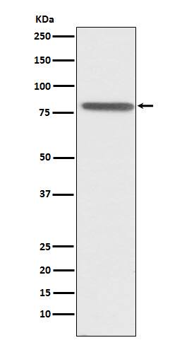 Western Blot: PSAP Antibody (SR2219) [NBP3-22242] - Western blot analysis using NBP3-22242 in HepG2 cell lysate.