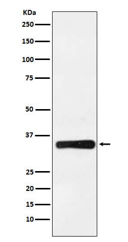 Western Blot: HOXB4 Antibody (SR1562) [NBP3-22246] - Western blot analysis using NBP3-22246 in Jurkat cell lysate.