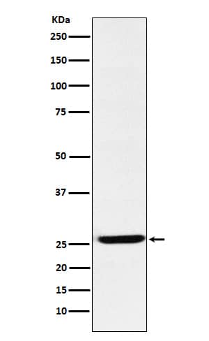 Western Blot: EBI3 Antibody (SR1394) [NBP3-22248] - Western blot analysis using NBP3-22248 in K562 cell lysate.