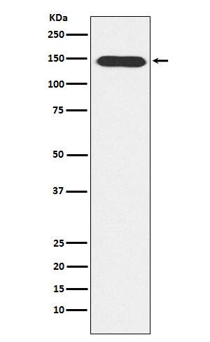 Western Blot: PLC-beta 3 Antibody (SR1198) [NBP3-22249] - Western blot analysis using NBP3-22249 in A431 cell lysate.