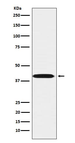 Western Blot LHX3 Antibody (SR1736)