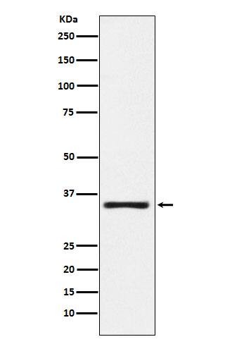 Western Blot: Kallikrein 2 Antibody (SR1547) [NBP3-22260] - Western blot analysis using NBP3-22260 in MOLT4 cell lysate.