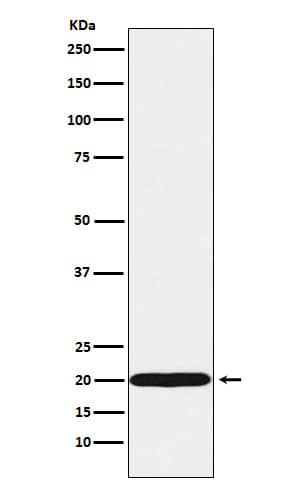 Western Blot: UbcH10/UBE2C Antibody (SR1319) [NBP3-22264] - Western blot analysis using NBP3-22264 in MCF7 cell lysate.