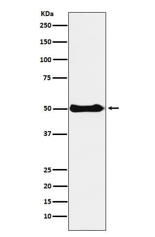 Western Blot: CSK Antibody (SR1874) [NBP3-22268] - Western blot analysis using NBP3-22268 in Ramos cell lysate.